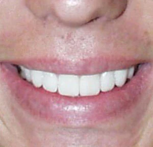 Case 2, after