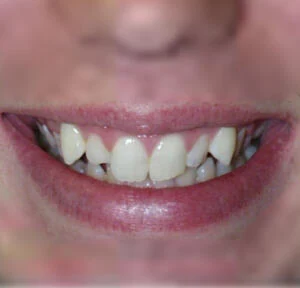 Case 2, before