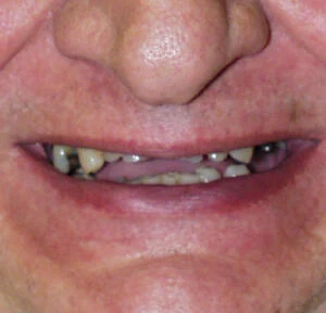 Case 3, before