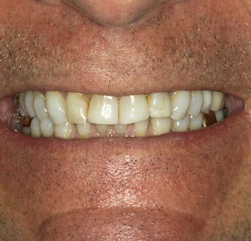 Case 1, before