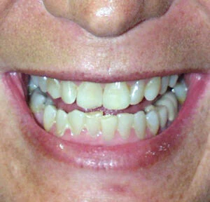 Case 4, before