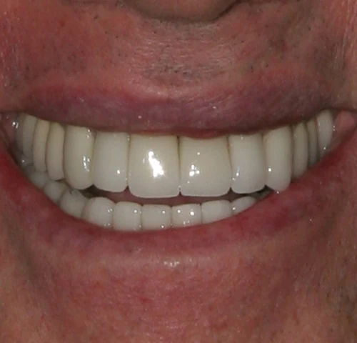 Case 5, after