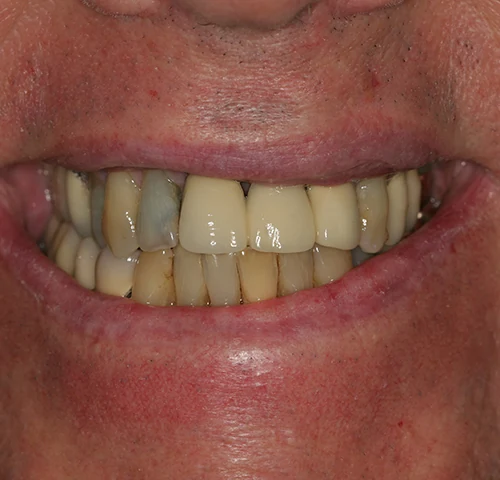 Case 5, before