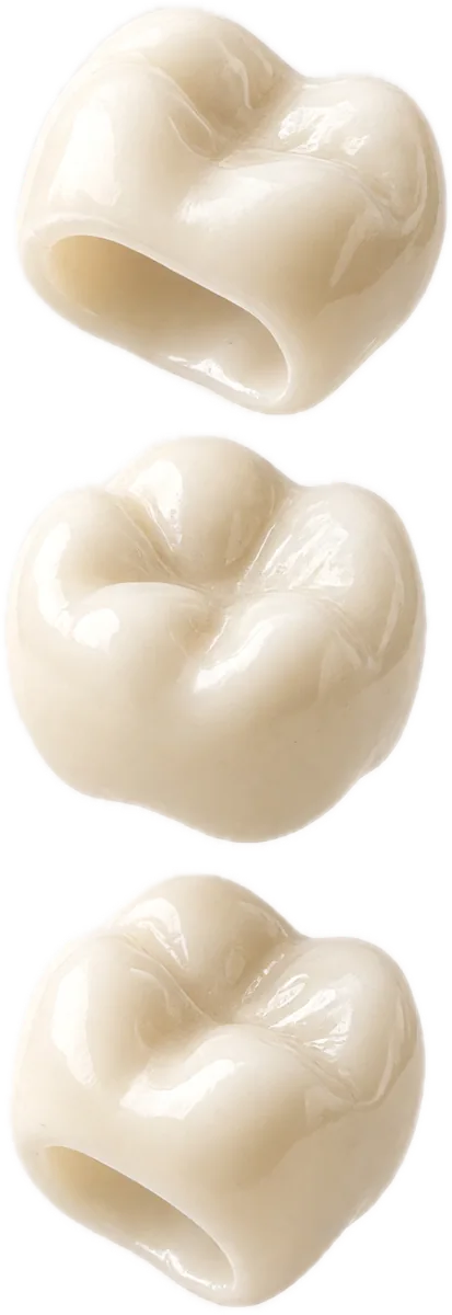 Porcelain dental crowns