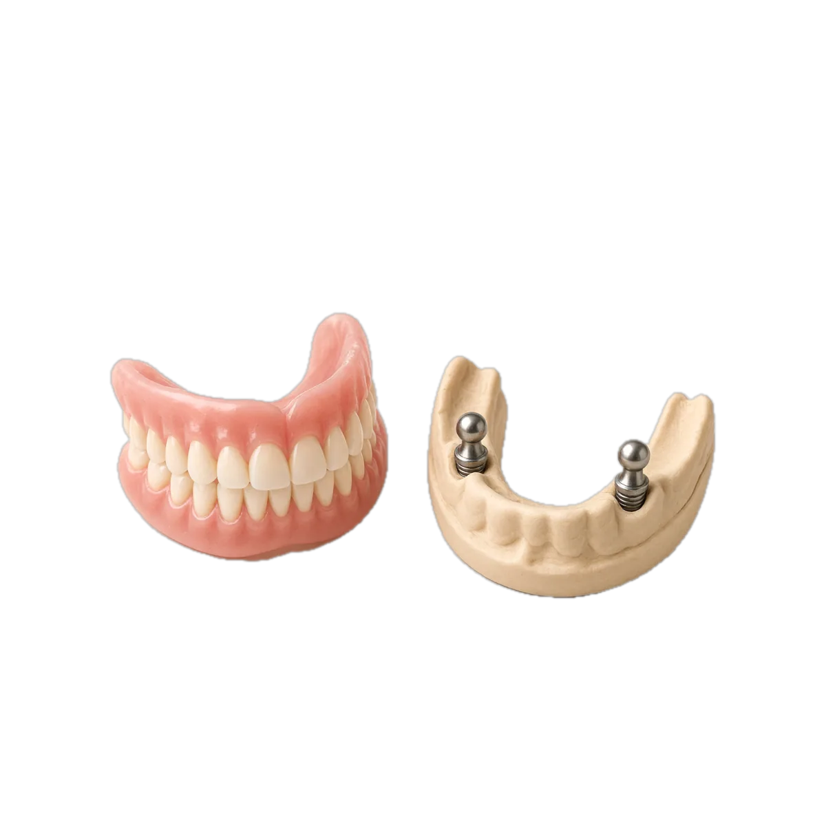 A snap-on denture and implant model