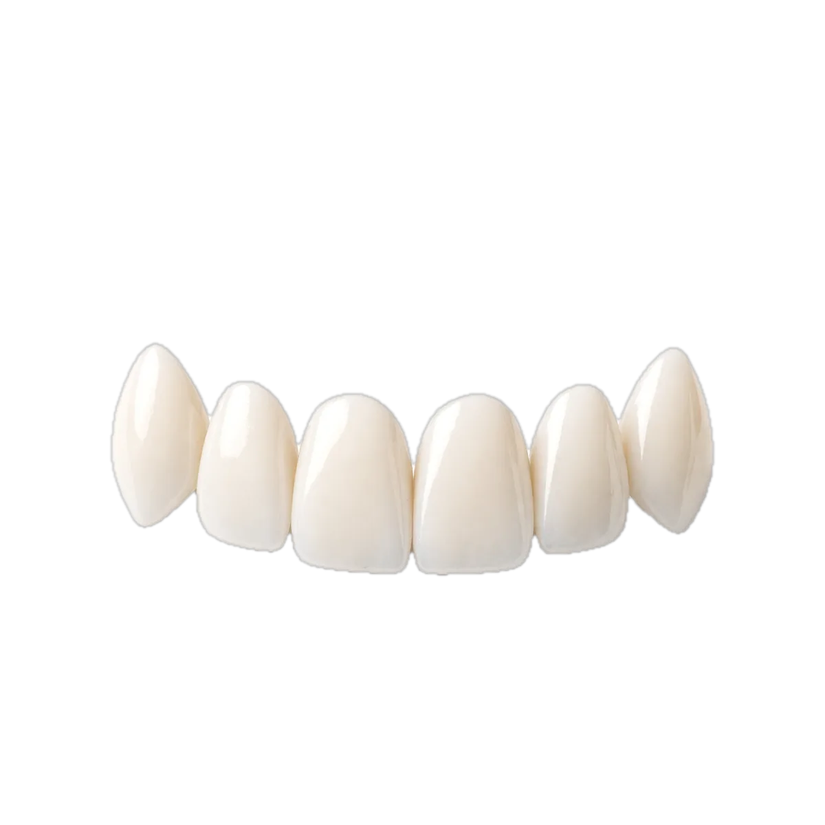 A set of porcelain veneers